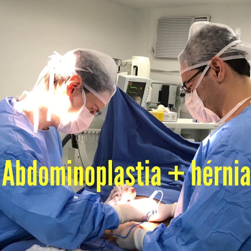 ABDOMEN HERNIA