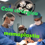 cola cirúrgica mamoplastia