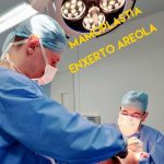 mamoplastia enxerto aréola