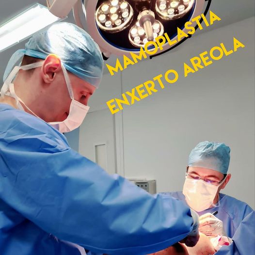 mamoplastia enxerto areola