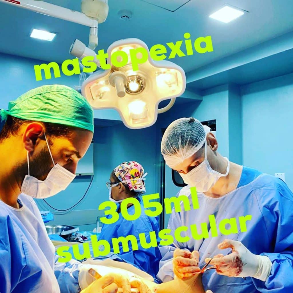 mastopexia com protese