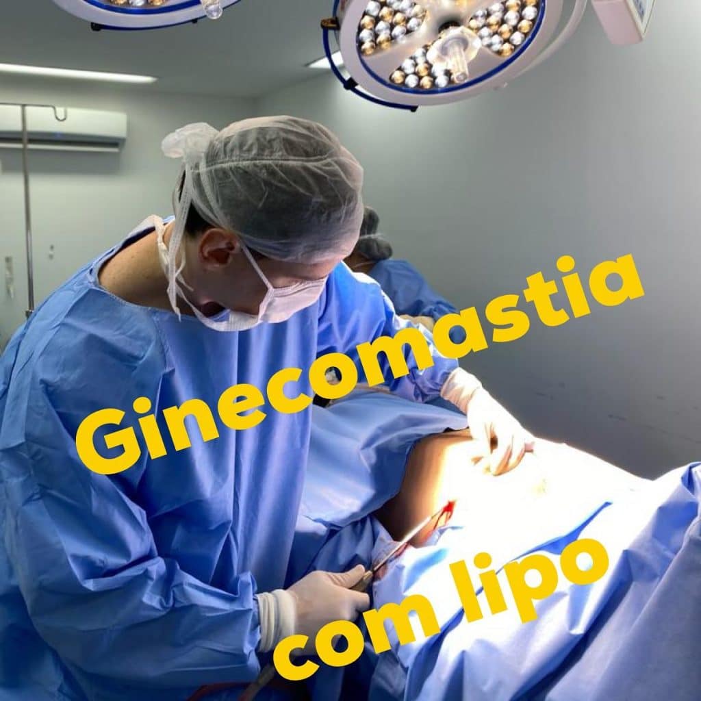 ginecomastia com lipo