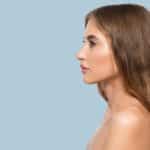 rinoplastia