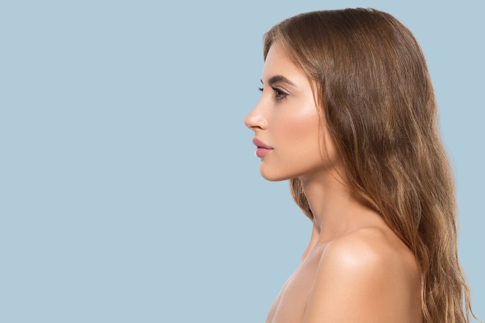 rinoplastia
