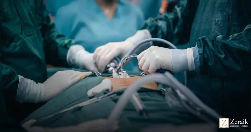 Entenda tudo sobre a ginecomastia: o que você precisa saber para agir agora