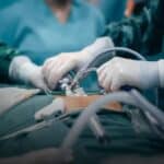 Entenda tudo sobre a ginecomastia: o que você precisa saber para agir agora