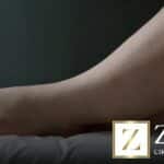 Inchaço nas pernas lipedema: entenda causas, sintomas e tratamentos eficazes