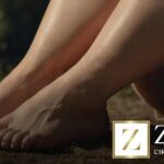 Sintomas do lipedema: como identificar os sinais que nem todo mundo conhece