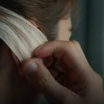 O que não se pode fazer depois da otoplastia? cuidados para evitar complicações